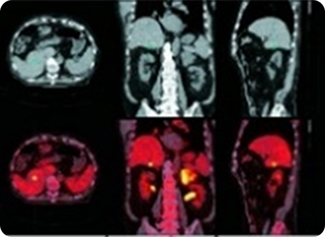 PET検査画像