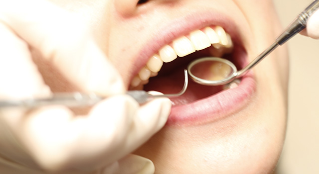 歯周組織精密検査